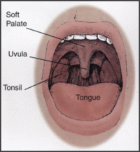 tonsils_medium