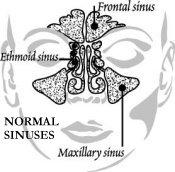 sinuses_medium